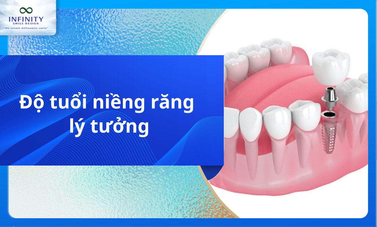 Độ tuổi niềng răng lý tưởng