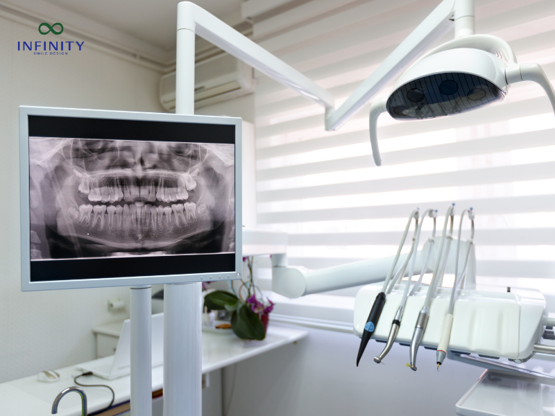 Niềng răng hô nhẹ bao nhiêu tiền tại các phòng khám nha khoa?
