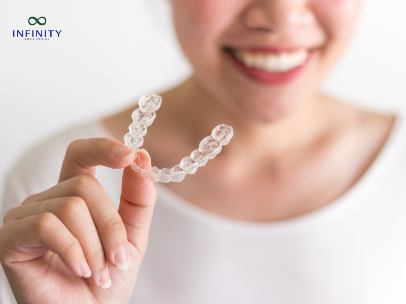 Chi phí niềng răng thưa là bao nhiêu?