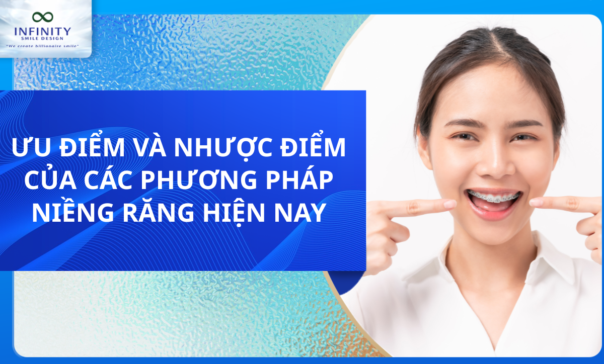 ƯU NHƯỢC ĐIỂM CỦA CÁC PHƯƠNG PHÁP NIỀNG RĂNG HIỆN NAY