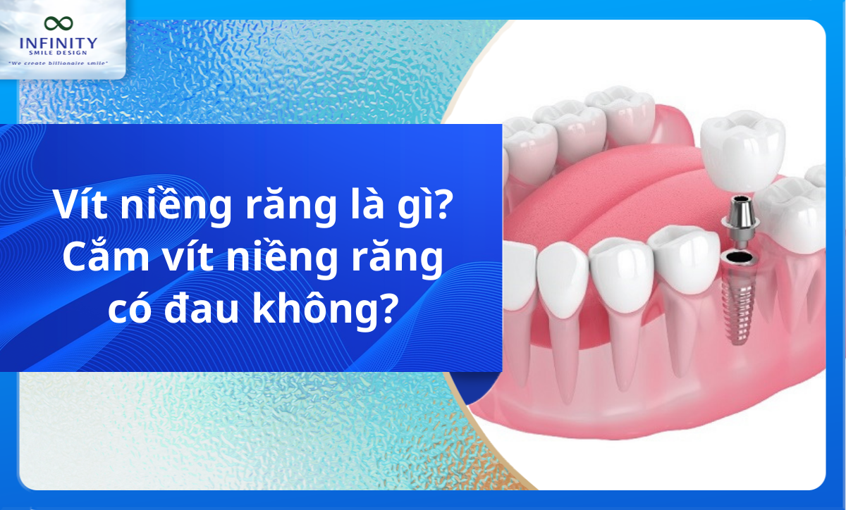 Vít niềng răng là gì? Cắm vít niềng răng có đau không?