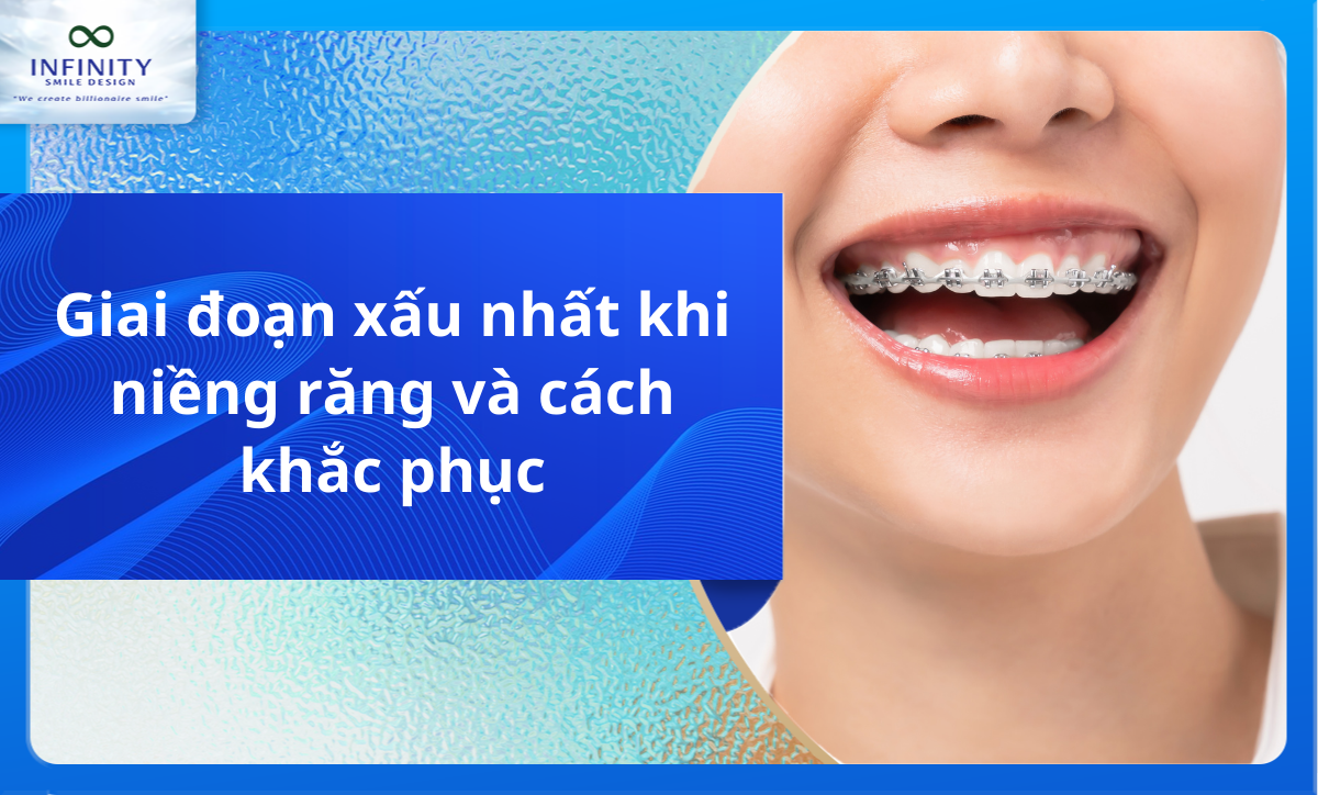 Giai đoạn xấu nhất khi niềng răng và cách khắc phục
