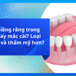 Nên niềng răng trong suốt hay mắc cài? Loại nào tốt và thẩm mỹ hơn?
