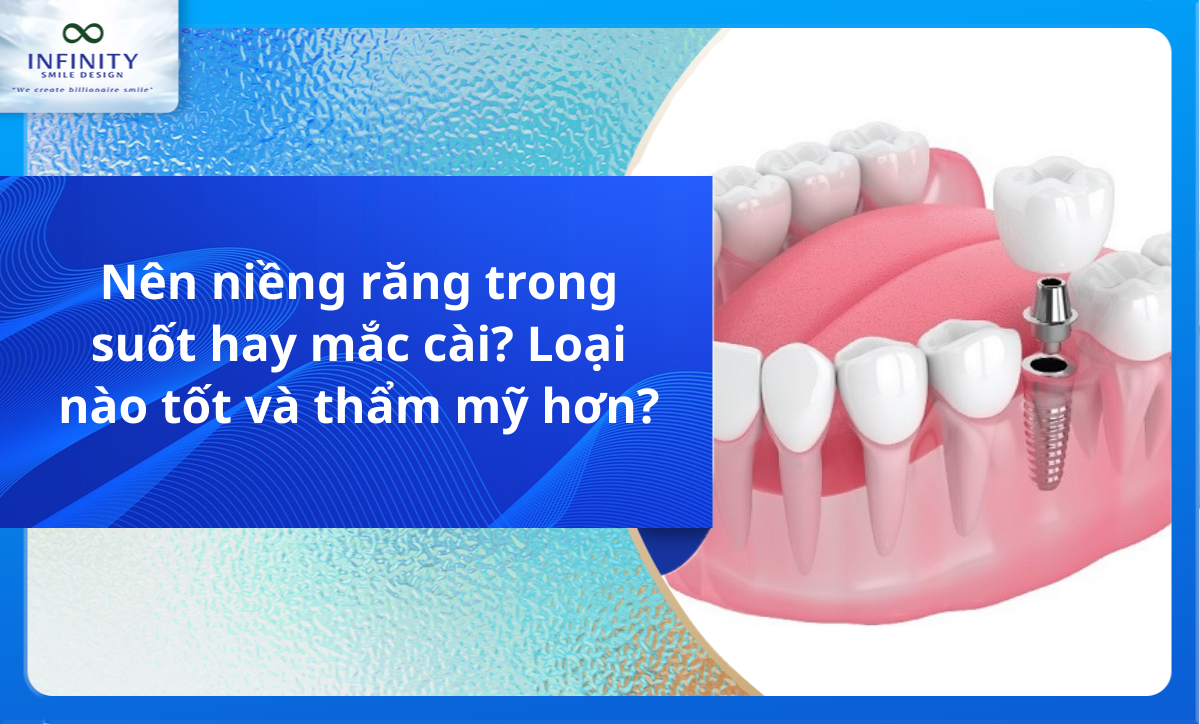 Nên niềng răng trong suốt hay mắc cài? Loại nào tốt và thẩm mỹ hơn?