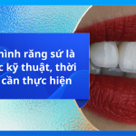 Phục hình răng sứ là gì? Các kỹ thuật, thời điểm cần thực hiện
