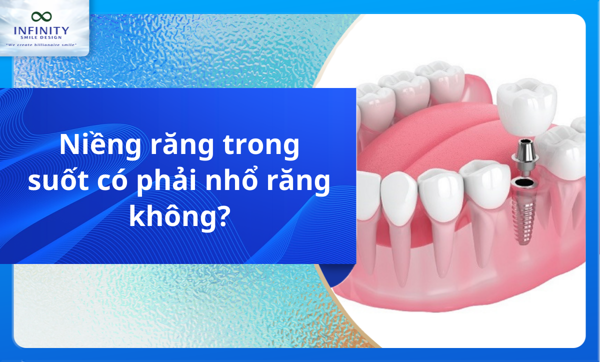 Niềng răng trong suốt có phải nhổ răng không?