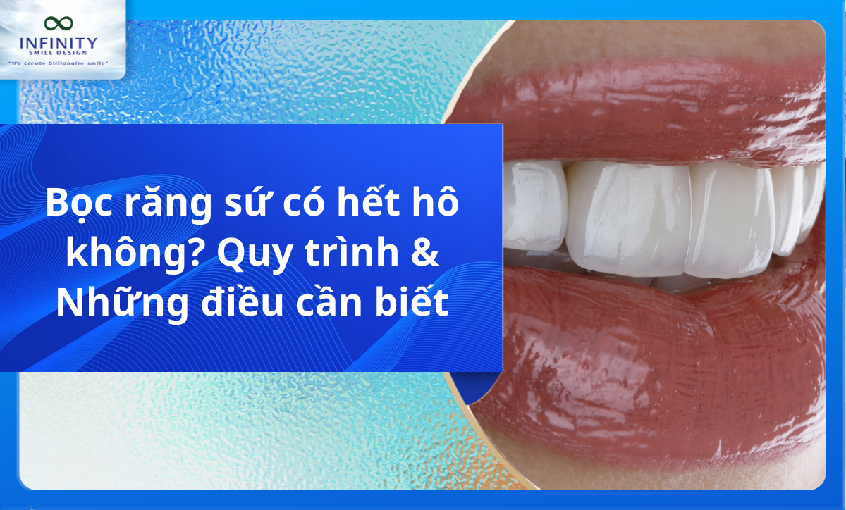 Bọc răng sứ có hết hô không? Quy trình & Những điều cần biết