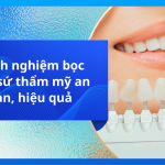 8 kinh nghiệm bọc răng sứ thẩm mỹ an toàn, hiệu quả