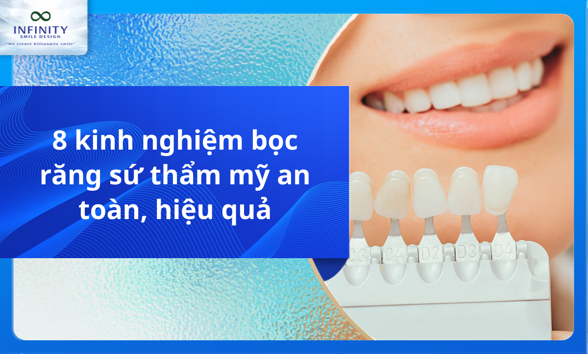 8 kinh nghiệm bọc răng sứ thẩm mỹ an toàn, hiệu quả