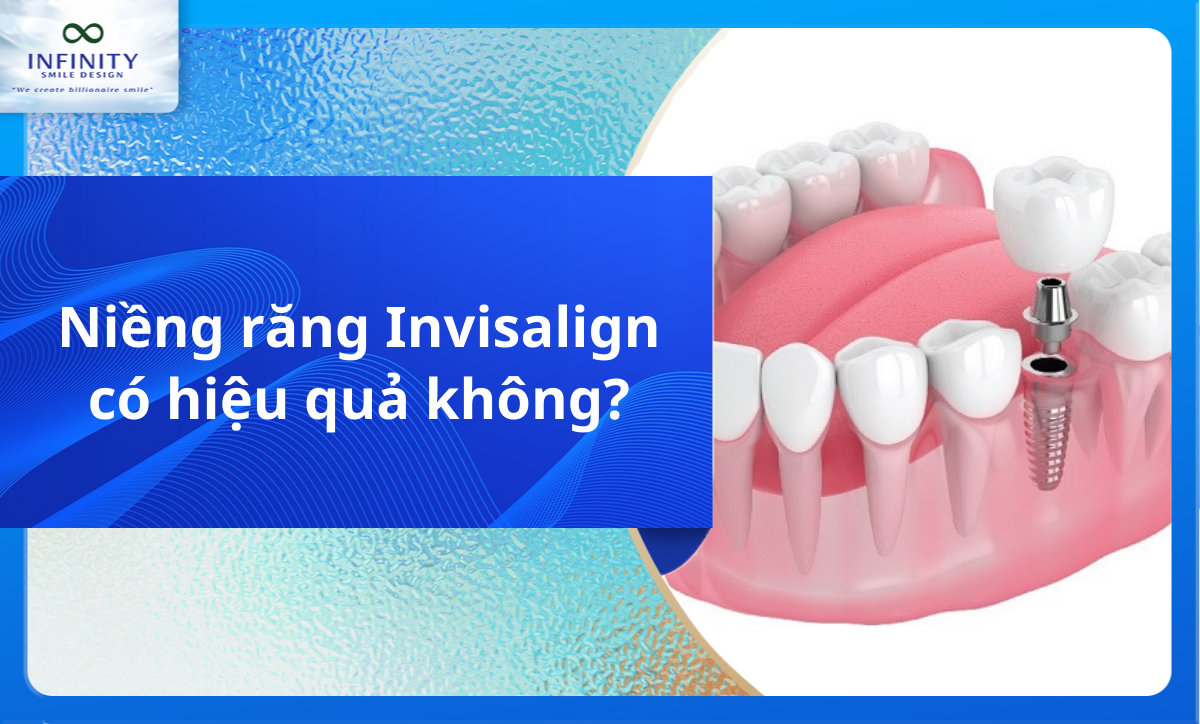 Niềng răng Invisalign có hiệu quả không?