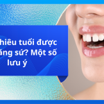 Bao nhiêu tuổi được làm răng sứ? Một số lưu ý