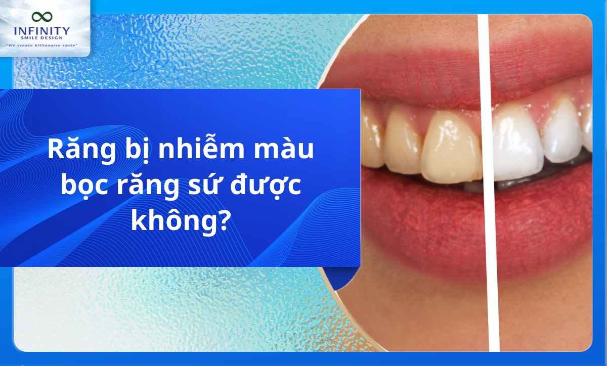 Răng bị nhiễm màu bọc răng sứ được không?