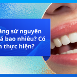 Bọc răng sứ nguyên hàm giá bao nhiêu? Có nên thực hiện?