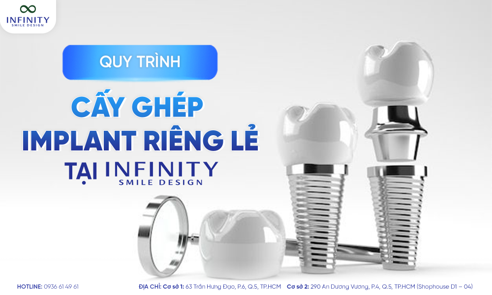 3. quy trình cấy implant lẻ