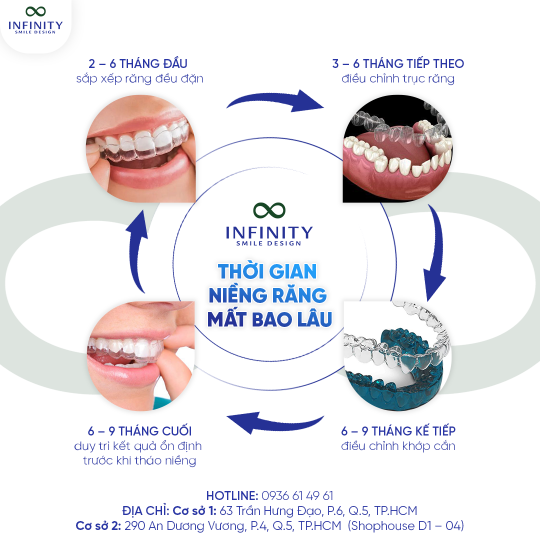 3. thời gian niềng răng 2