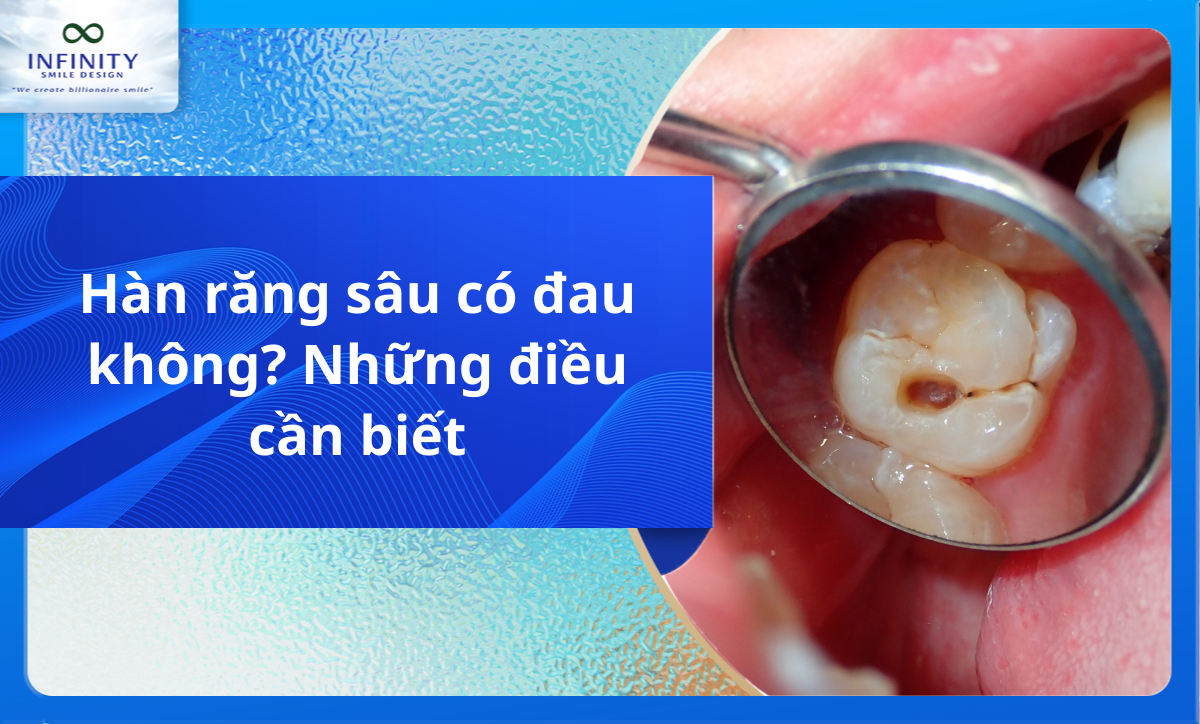 Hàn răng sâu có đau không? Những điều cần biết