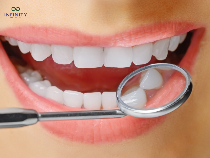 Các kỹ thuật phục hình răng sứ phổ biến