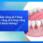 Có thể kéo răng số 7 thay răng số 6, răng số 8 thay răng số 7 được không?