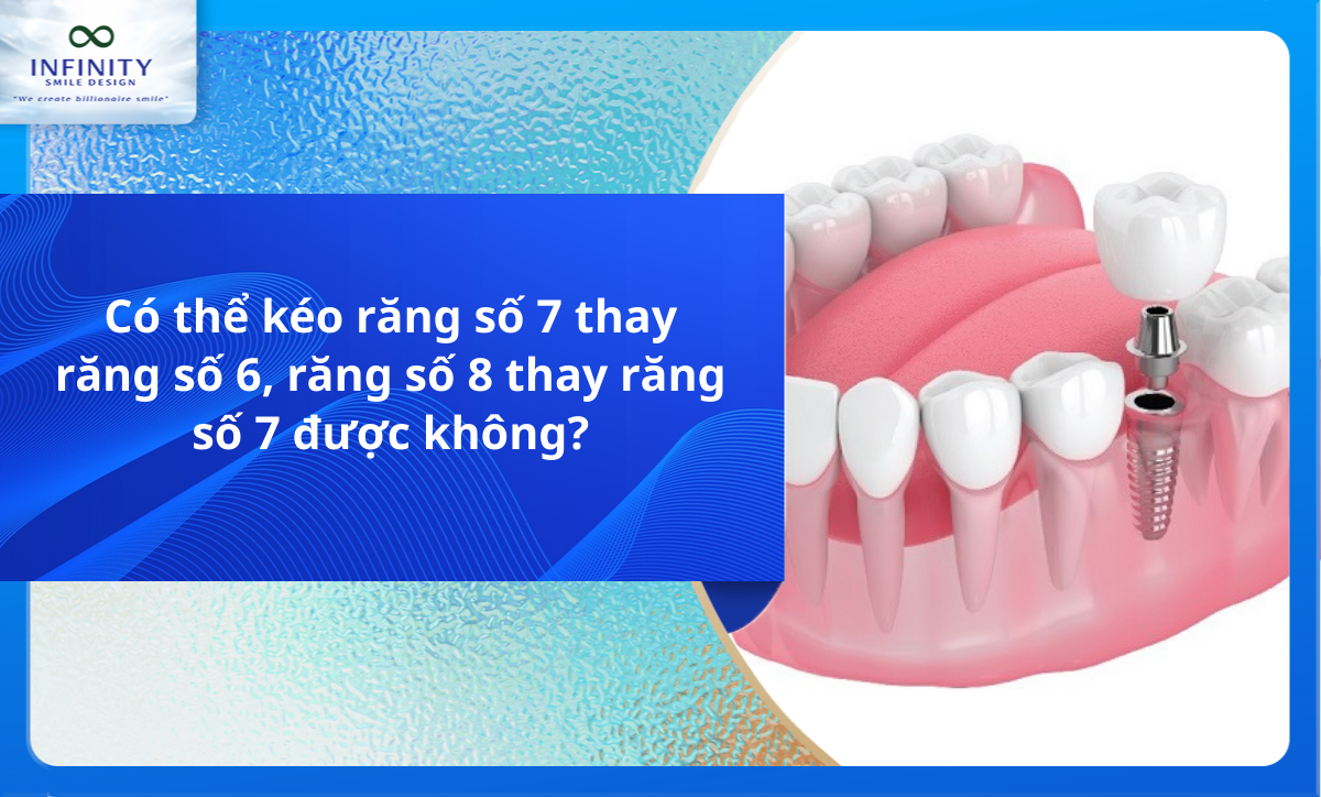 Có thể kéo răng số 7 thay răng số 6, răng số 8 thay răng số 7 được không?
