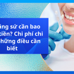 Bọc răng sứ cần bao nhiêu tiền? Chi phí chi tiết, những điều cần biết