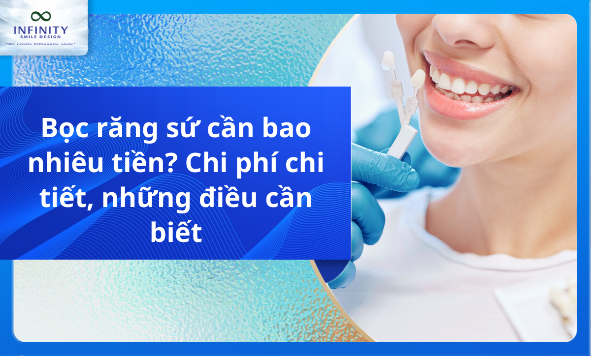 Bọc răng sứ cần bao nhiêu tiền? Chi phí chi tiết, những điều cần biết
