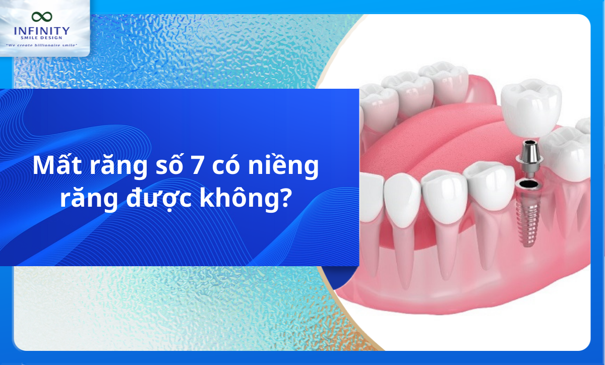 Mất răng số 7 có niềng răng được không?
