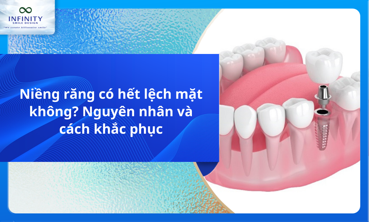 Niềng răng có hết lệch mặt không? Nguyên nhân và cách khắc phục