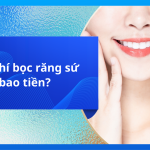 Chi phí bọc răng sứ bao tiền?