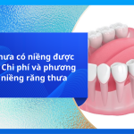 Răng thưa có niềng được không? Chi phí và phương pháp niềng răng thưa
