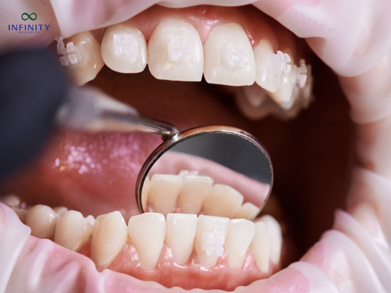 Lập phác đồ điều trị chi tiết Lập phác đồ điều trị chi tiết