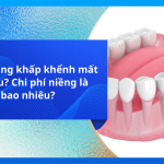 Niềng răng khấp khểnh mất bao lâu? Chi phí niềng là bao nhiêu?