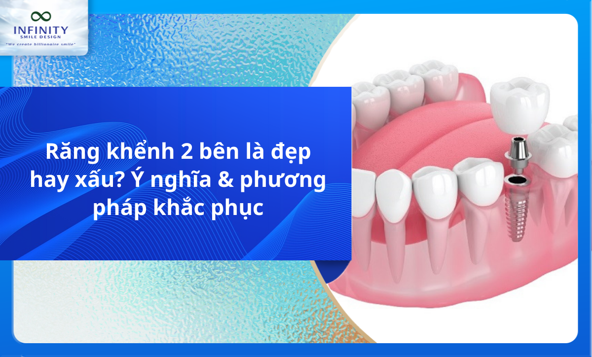 Răng khểnh 2 bên là đẹp hay xấu? Ý nghĩa & phương pháp khắc phục