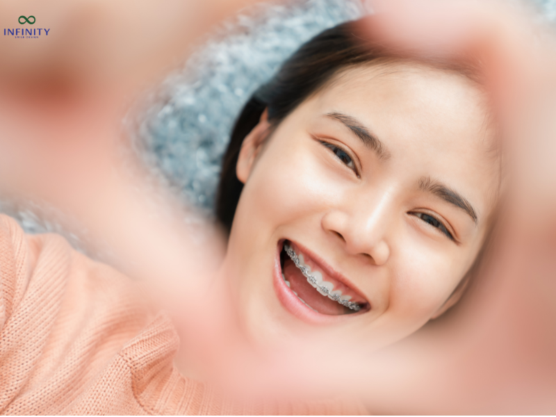 ĐỘ TUỔI NIỀNG RĂNG LÝ TƯỞNG 5 Bao nhiêu tuổi thì không niềng răng được nữa?