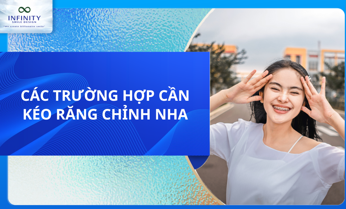 CÁC TRƯỜNG HỢP CẦN KÉO RĂNG CHỈNH NHA