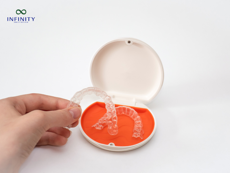 Niềng răng trong suốt là gì? Đặc điểm của niềng răng trong suốt