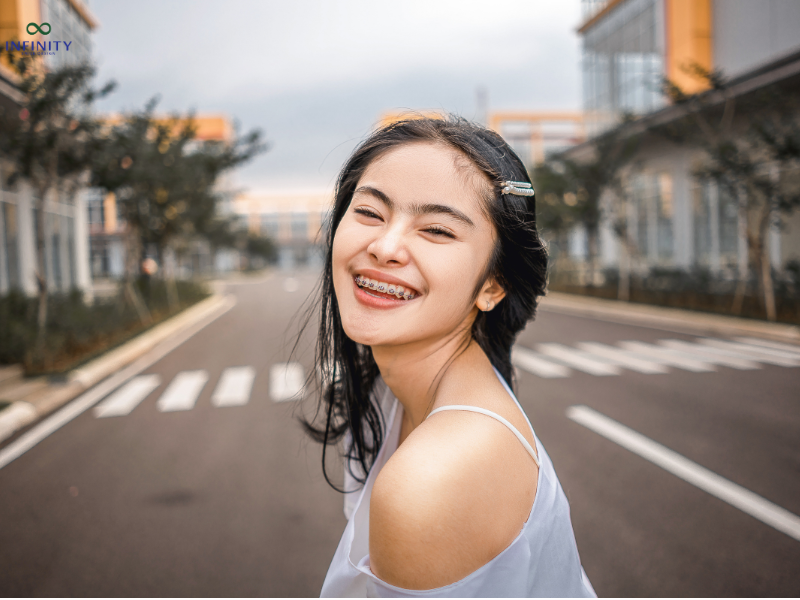 Niềng răng mang lại nhiều lợi ích về thẩm mỹ và sức khỏe răng miệng