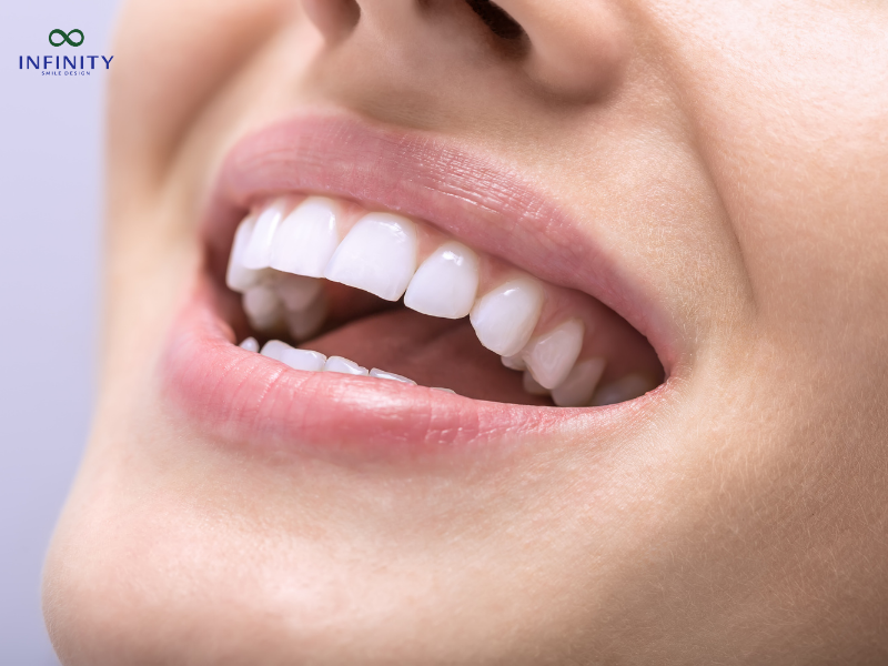 Các yếu tố ảnh hưởng đến thời gian làm răng sứ