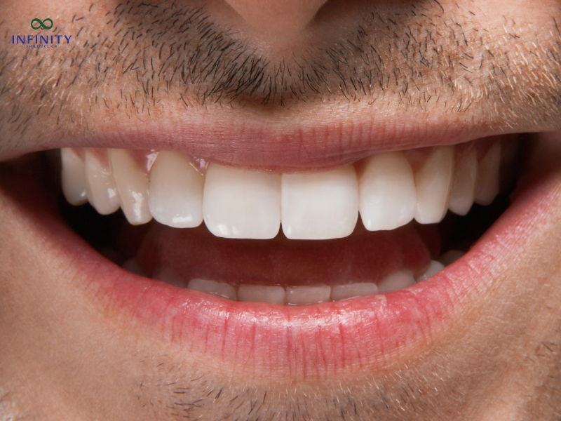 Ưu điểm của việc bọc răng sứ cho răng bị nhiễm màu