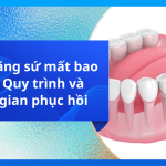 Làm răng sứ mất bao lâu? Quy trình và thời gian phục hồi