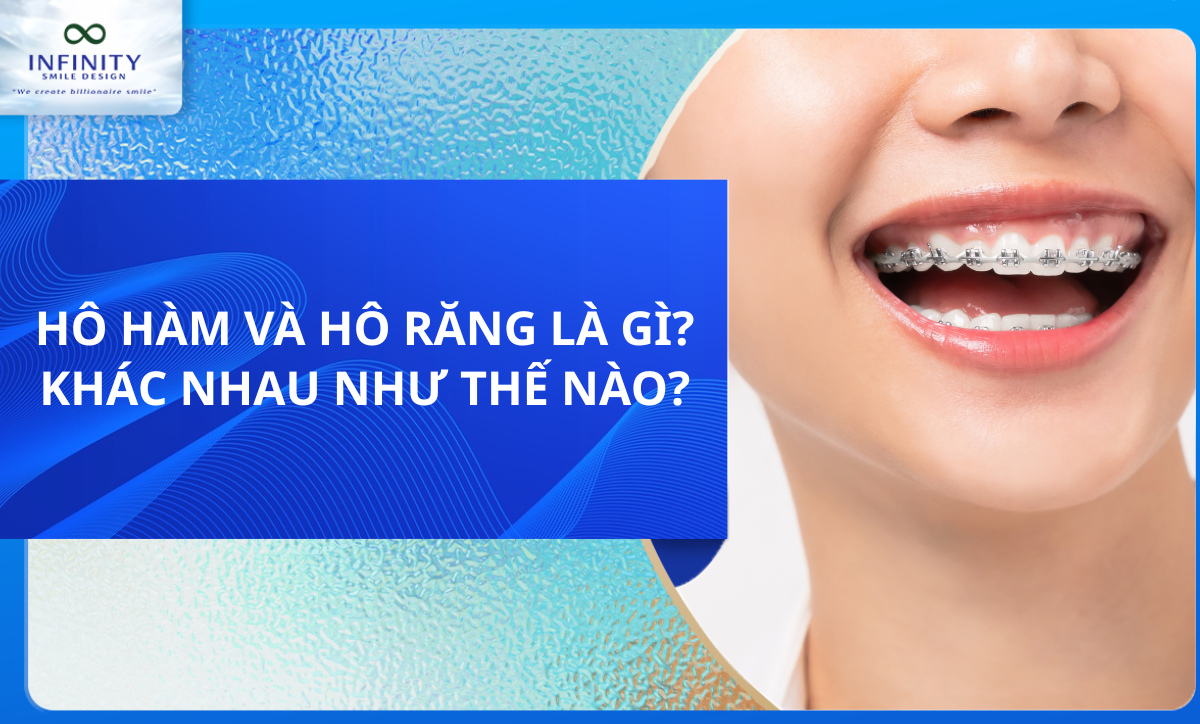 HÔ HÀM VÀ HÔ RĂNG LÀ GÌ? KHÁC NHAU NHƯ THẾ NÀO?