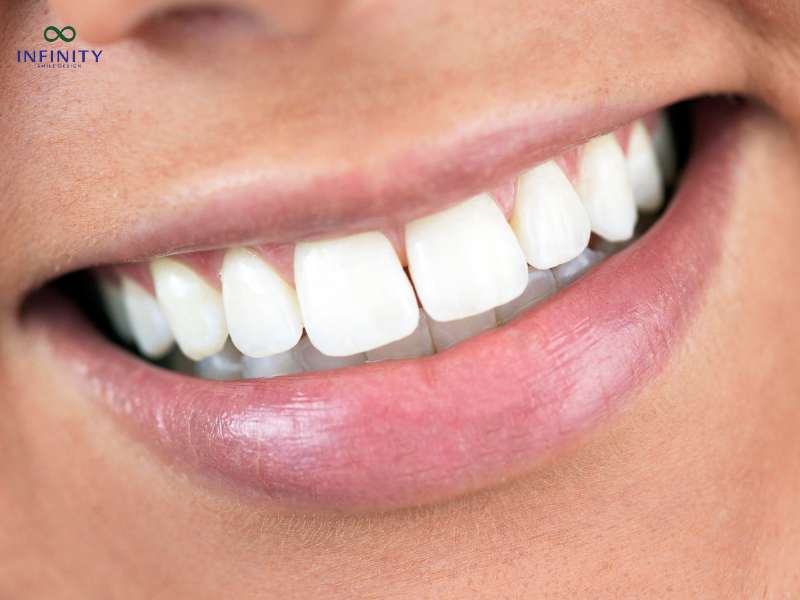 Các trường hợp ngoại lệ và lưu ý khi bọc răng sứ với bảo hiểm y tế