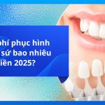 Chi phí phục hình răng sứ bao nhiêu tiền 2025?