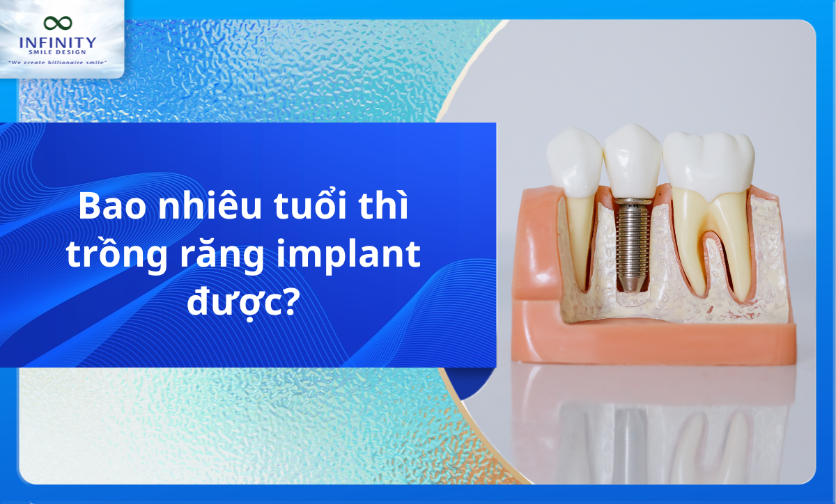 Bao nhiêu tuổi thì trồng răng implant được?