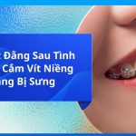 Bí Mật Đằng Sau Tình Trạng Cắm Vít Niềng Răng Bị Sưng