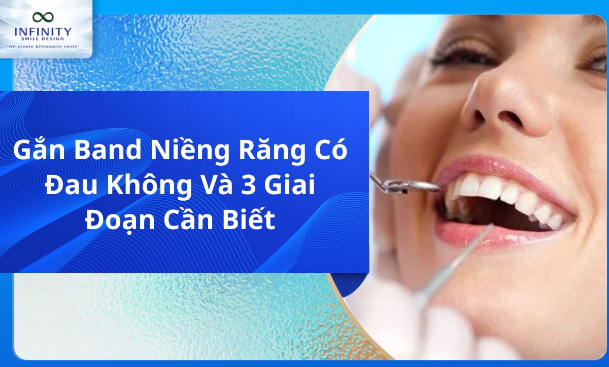 Gắn Band Niềng Răng Có Đau Không Và 3 Giai Đoạn Cần Biết