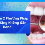 Lựa Chọn 2 Phương Pháp Niềng Răng Không Gắn Band