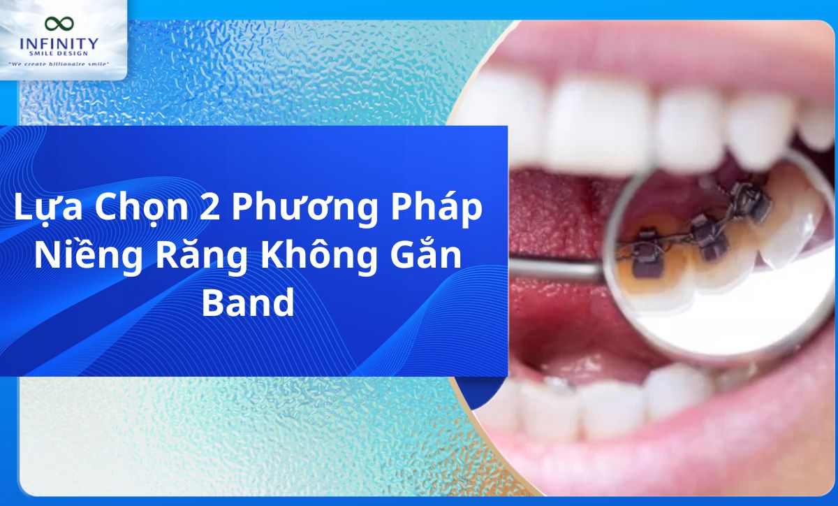 Lựa Chọn 2 Phương Pháp Niềng Răng Không Gắn Band