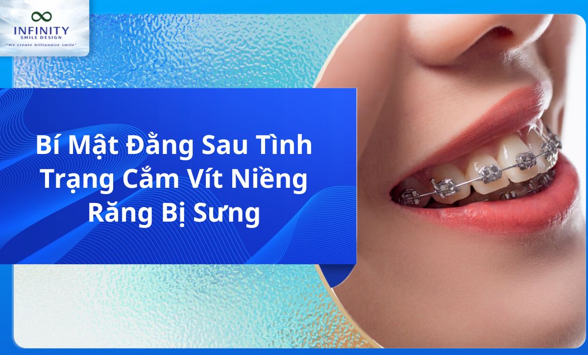 Bí Mật Đằng Sau Tình Trạng Cắm Vít Niềng Răng Bị Sưng