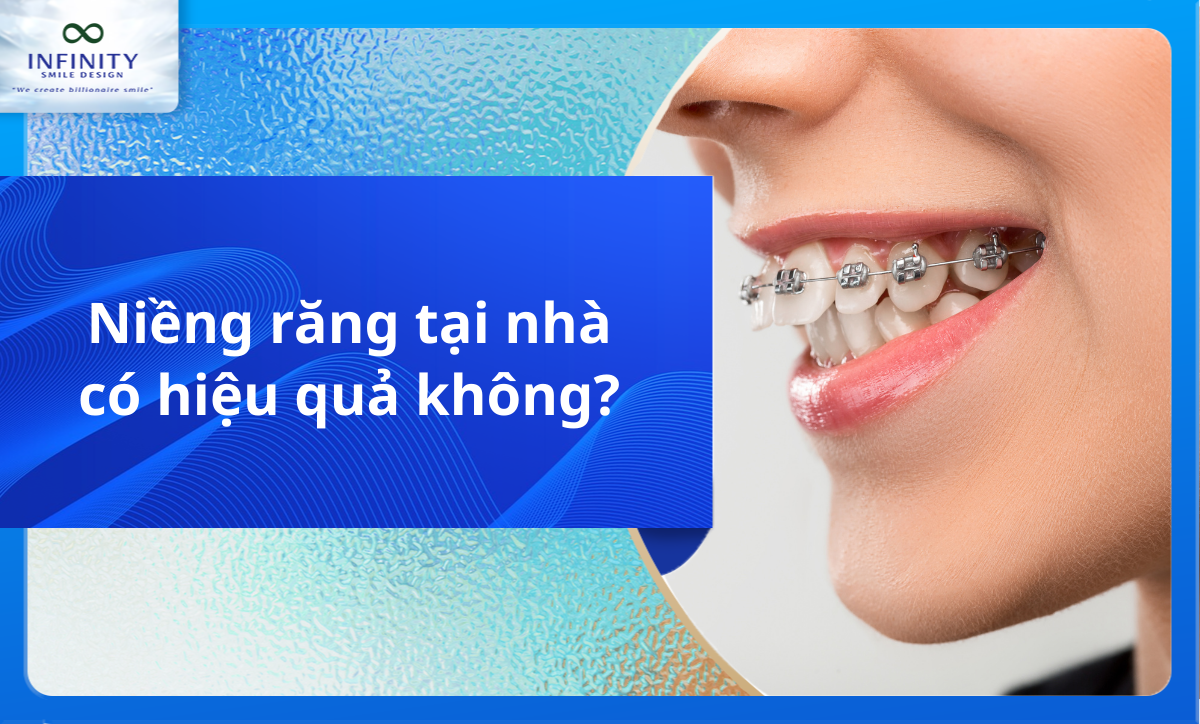 Niềng răng tại nhà có hiệu quả không?