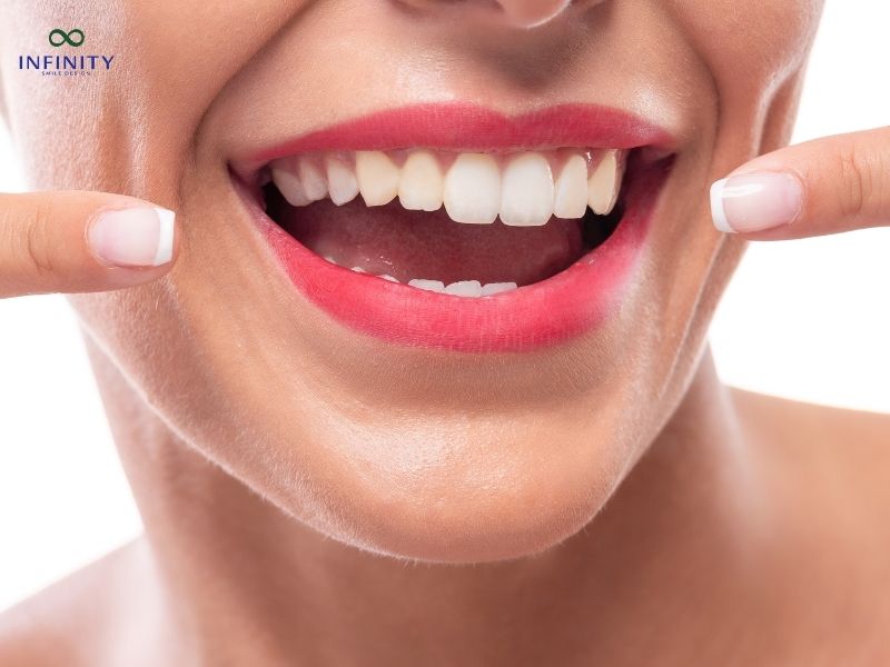 Tuổi thọ của răng sứ